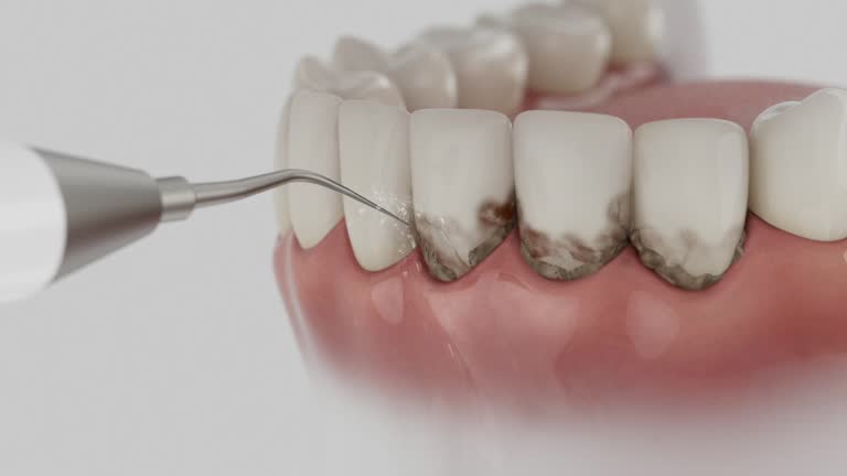 Reliable Dental contractor in Fairport Harbor, OH by Dentist Open Now